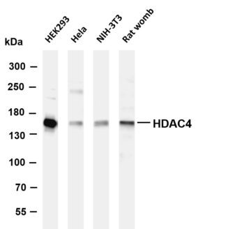 HDAC4 Rabbit Monoclonal Antibody