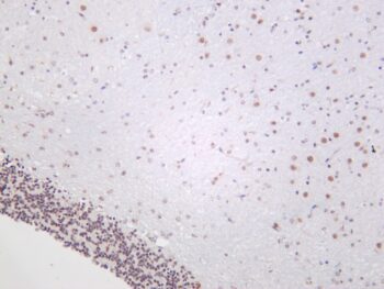 HDAC4 Rabbit Monoclonal Antibody - Image 2