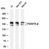 PDGFR-β Rabbit Monoclonal Antibody