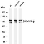 PDGFR-β Rabbit Monoclonal Antibody