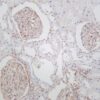 PDGFR-β Rabbit Monoclonal Antibody - Image 2