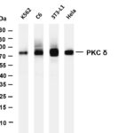 PKC δ Rabbit Monoclonal Antibody