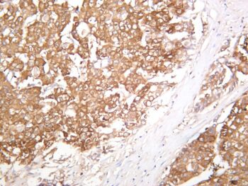 PUMA Rabbit Monoclonal Antibody - Image 2
