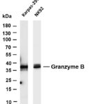 Granzyme B Rabbit Monoclonal Antibody