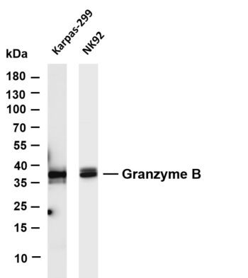 Granzyme B Rabbit Monoclonal Antibody