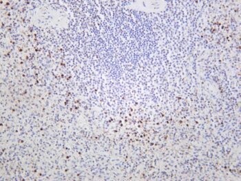 Granzyme B Rabbit Monoclonal Antibody - Image 2