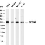 SESN2 Rabbit Monoclonal Antibody
