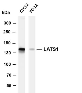 LATS1 Rabbit Monoclonal Antibody - Image 2