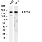 LATS1 Rabbit Monoclonal Antibody