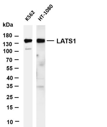LATS1 Rabbit Monoclonal Antibody