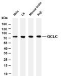 GCLC Rabbit Monoclonal Antibody