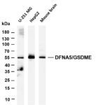 DFNA5/GSDME Rabbit Monoclonal Antibody