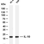 IL-10 Rabbit Monoclonal Antibody