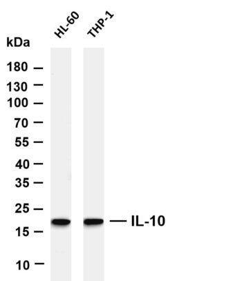 IL-10 Rabbit Monoclonal Antibody
