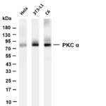 PKC α Rabbit Monoclonal Antibody