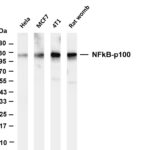 NFkB-p100 Rabbit Monoclonal Antibody