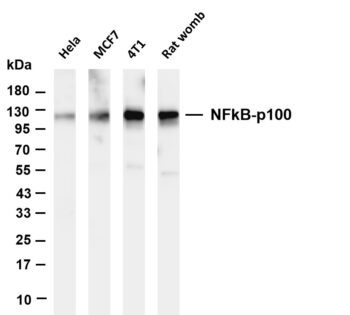 NFkB-p100 Rabbit Monoclonal Antibody