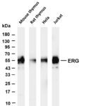ERG Rabbit Monoclonal Antibody