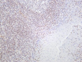 ERG Rabbit Monoclonal Antibody - Image 2