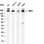 Met Rabbit Monoclonal Antibody
