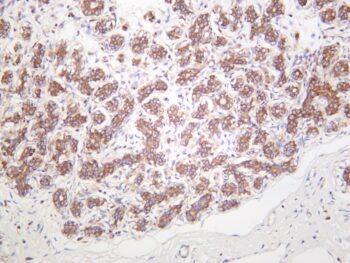 Met Rabbit Monoclonal Antibody - Image 2