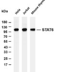 STAT6 Rabbit Monoclonal Antibody