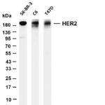 HER2 Rabbit Monoclonal Antibody