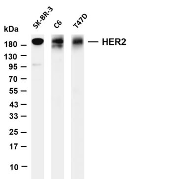HER2 Rabbit Monoclonal Antibody