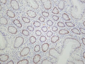 HNF-3α Rabbit Monoclonal Antibody - Image 2