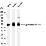 Cytokeratin 14 Rabbit Monoclonal Antibody