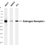 Estrogen Receptor α Rabbit Monoclonal Antibody