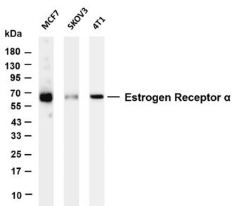 Estrogen Receptor α Rabbit Monoclonal Antibody