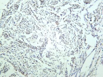 Estrogen Receptor α Rabbit Monoclonal Antibody - Image 2