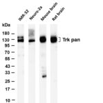 Trk pan Rabbit Monoclonal Antibody