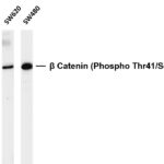 β Catenin (Phospho Thr41/Ser45) Rabbit Monoclonal Antibody