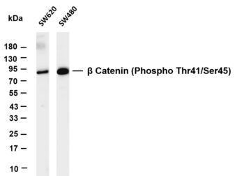 β Catenin (Phospho Thr41/Ser45) Rabbit Monoclonal Antibody