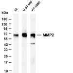MMP2 Rabbit Monoclonal Antibody