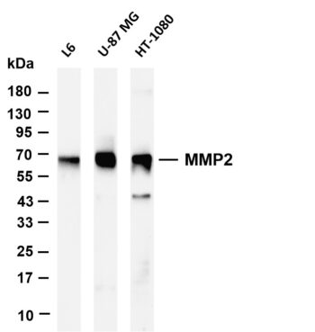MMP2 Rabbit Monoclonal Antibody