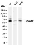SOX10 Rabbit Monoclonal Antibody
