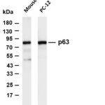 p63 Rabbit Monoclonal Antibody