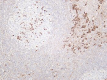 MLKL Rabbit Monoclonal Antibody - Image 2