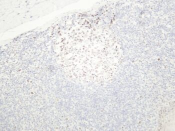 EZH2 Rabbit Monoclonal Antibody - Image 2