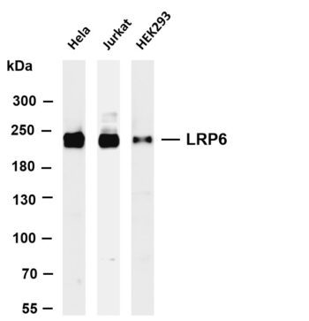 LRP6 Rabbit Monoclonal Antibody