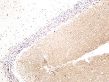 LRP6 Rabbit Monoclonal Antibody - Image 2