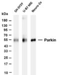 Parkin Rabbit Monoclonal Antibody