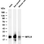 MYL9 Rabbit Monoclonal Antibody