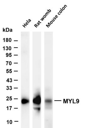 MYL9 Rabbit Monoclonal Antibody