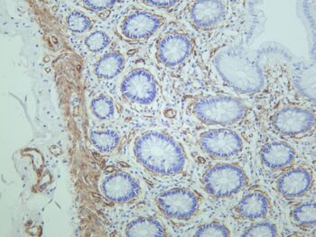 MYL9 Rabbit Monoclonal Antibody - Image 2