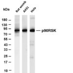 p90RSK Rabbit Monoclonal Antibody