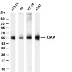 XIAP Rabbit Monoclonal Antibody